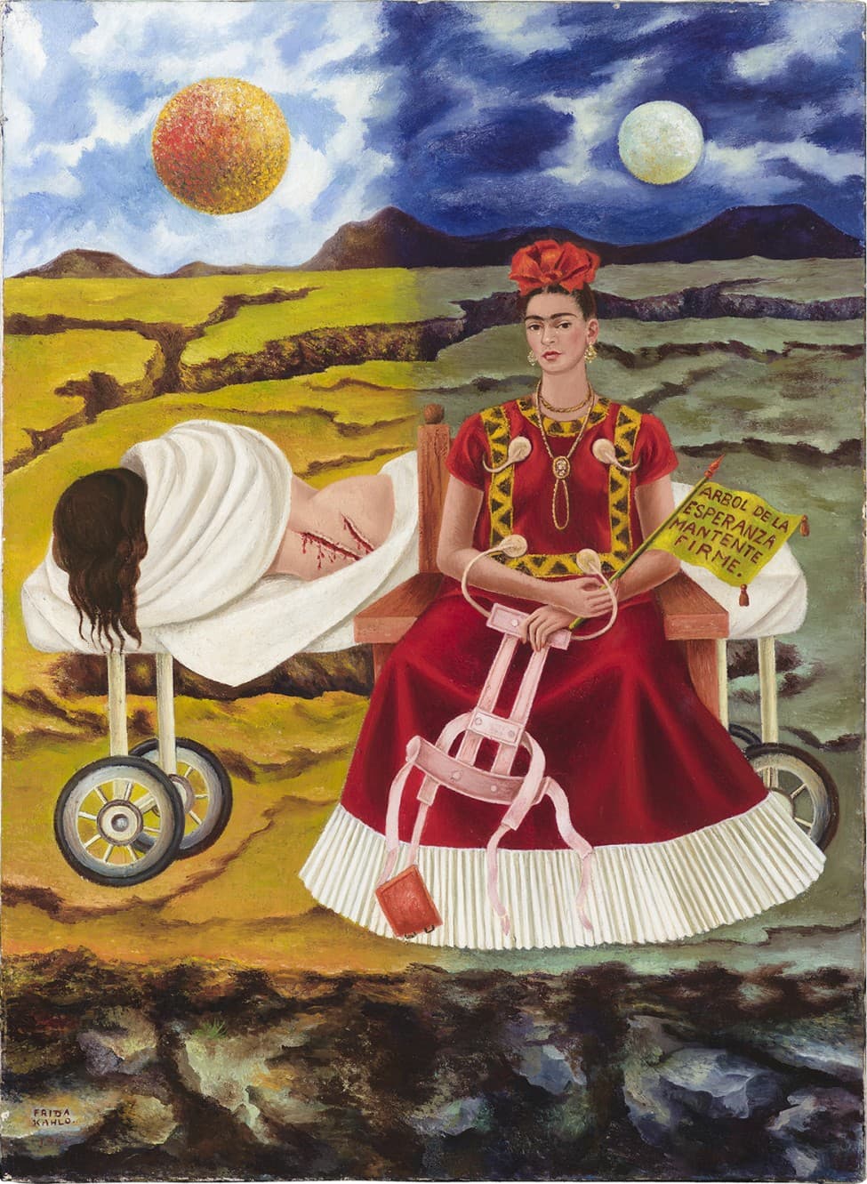 Arbol de la Esperanza (Tree of Hope) by Frida Kahlo